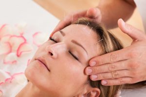 Acupuncture for Headaches & Migraines