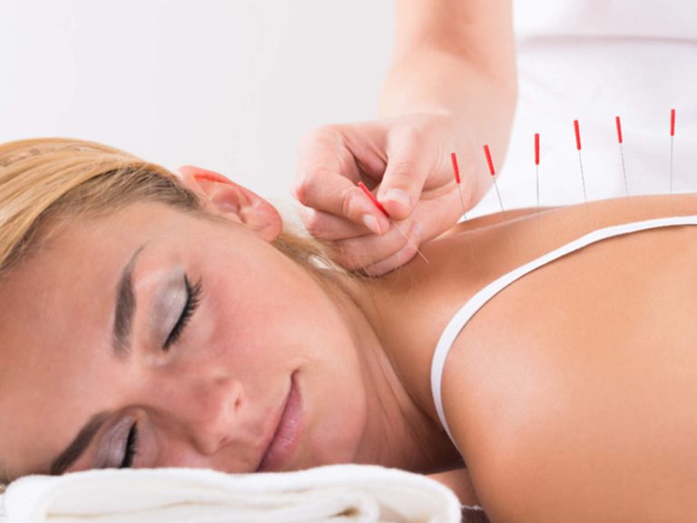 Acupuncture for chronic pain