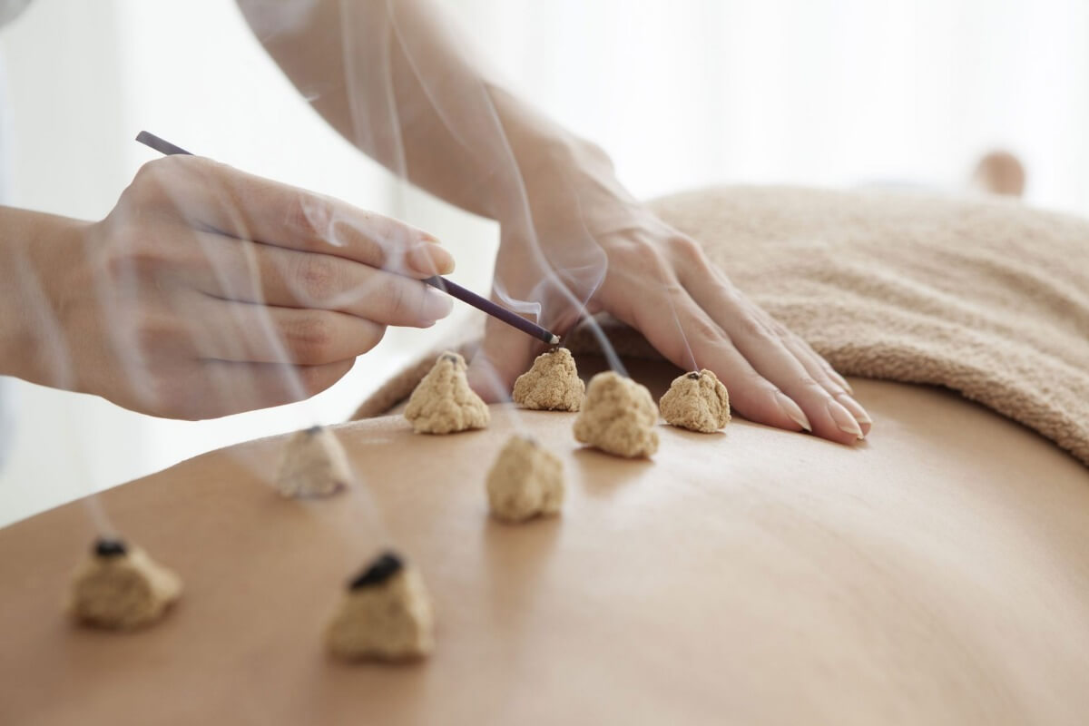 Role Of Moxibustion In Acupuncture Perth
