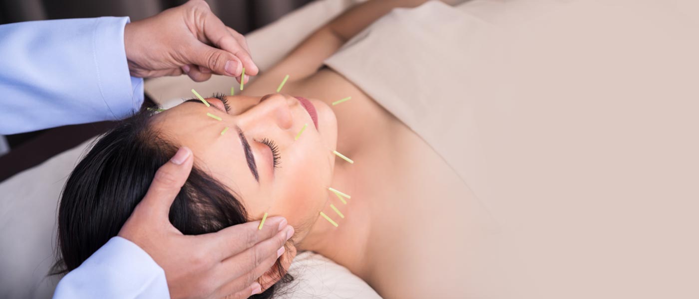 The Healing Touch: Acupuncture in Fremantle