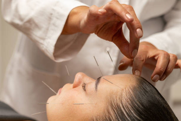 Acupuncture specialist inserting needle into patient's face due treatment. She is stimulating energy flow through the body for faster relaxation and recovery.