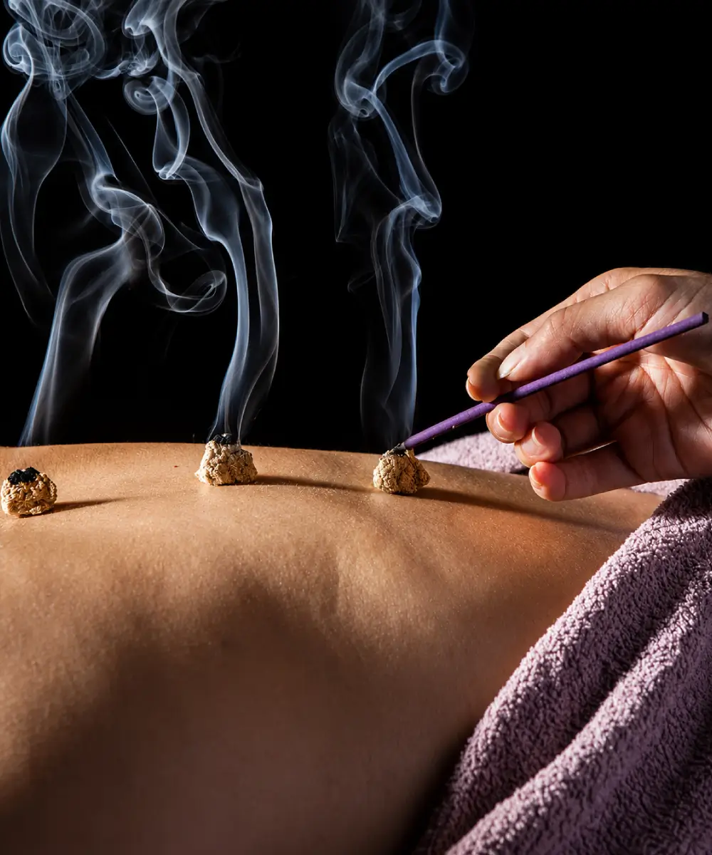 Moxibustion