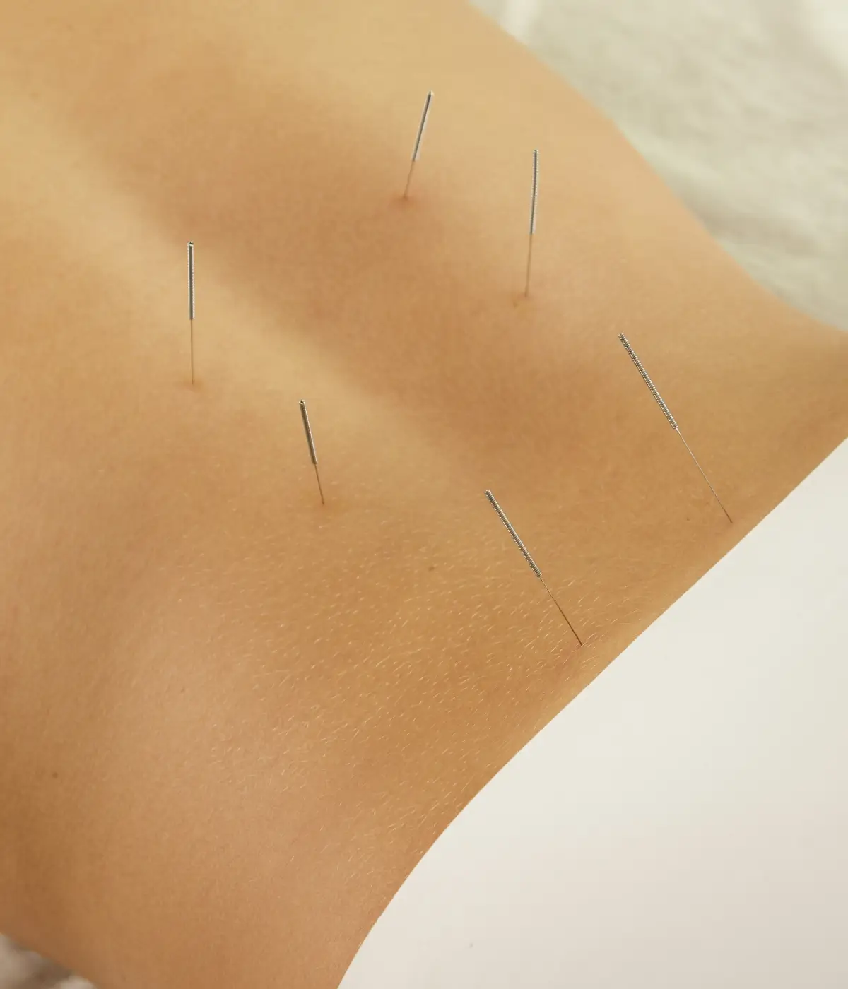 Tao Acupuncture images (3)