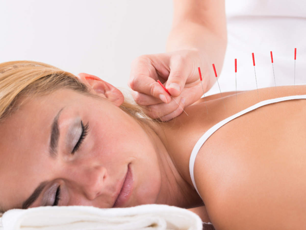 Role Of Acupuncture In Reducing Chronic Pain