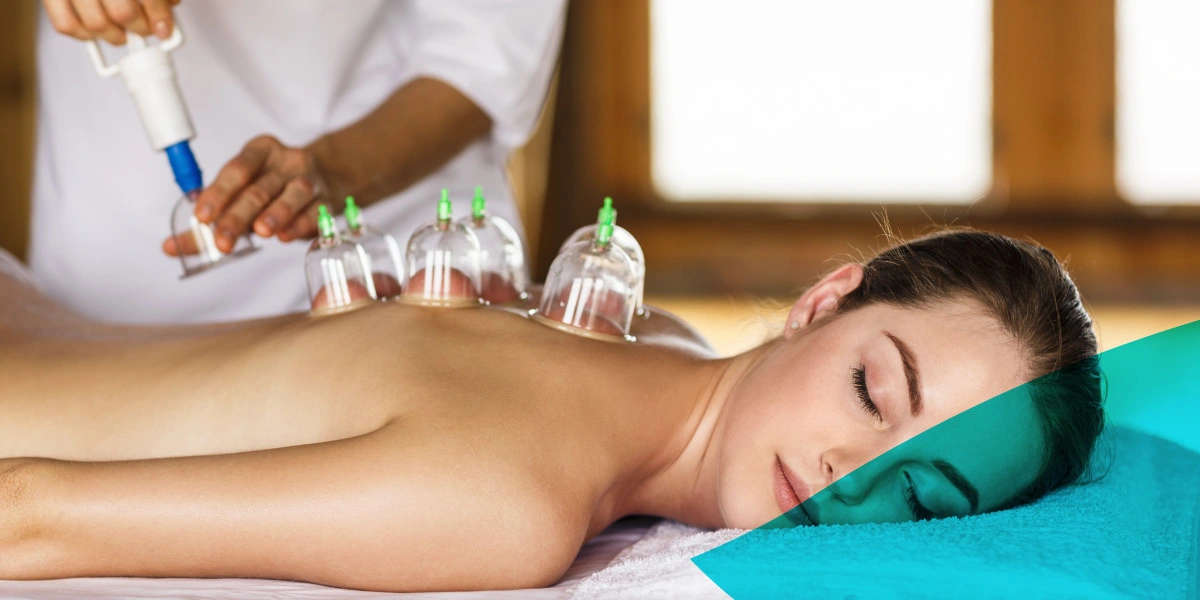 Cupping Therapy for Modern Health Issues