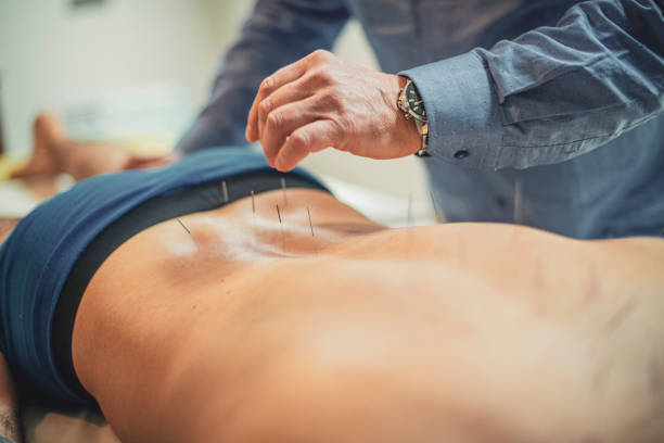 A man is receiving acupuncture therapy. His back is full of needles and in the background an acupuncturist is visible continuing the insertation.
